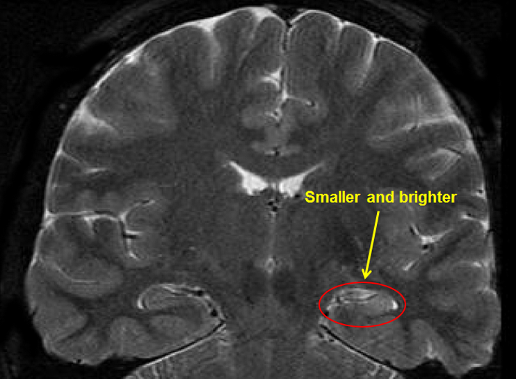 tle-scan